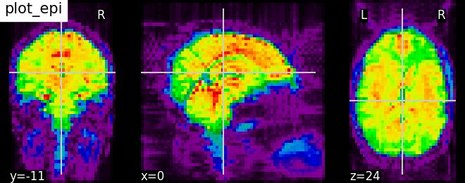 Github Brain Mapping Epi Graph Epi Graph Localizes The Epileptogenic - Vintage Picture Collection - HD Quality