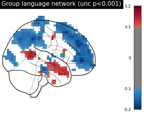 Bids Dataset First And Second Level Analysis Nilearn - Beautiful Gradient Photo - Desktop