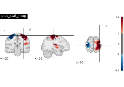 Nilearn Plotting Plot Glass Brain Nilearn - Nature Pictures - High Quality Ultra HD Collection