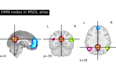 Make Nilearn Plotting Plot Stat Map And Nilearn Plotting Plot Glass - Download Modern Minimal Photo | HD