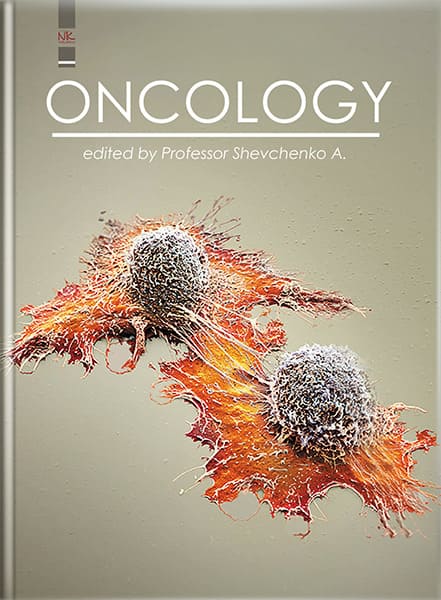 Oncology
