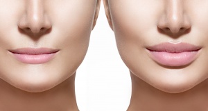 According to the american society for aesthetic plastic surgery's 2018 statistics . Lip Fillers Scottsdale Dallas Reviews National Laser Institute Medical Spa