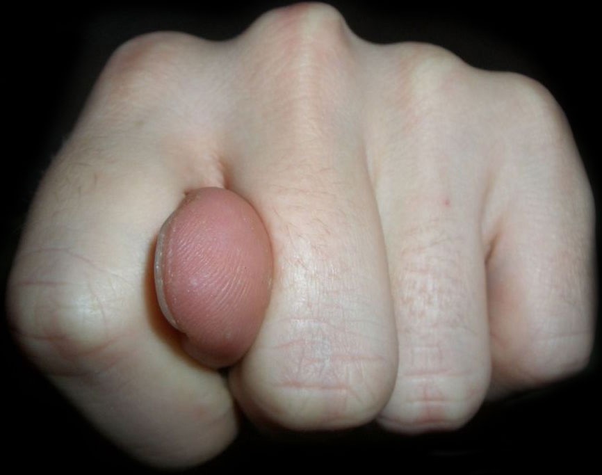 nolur? işte böyle olur!