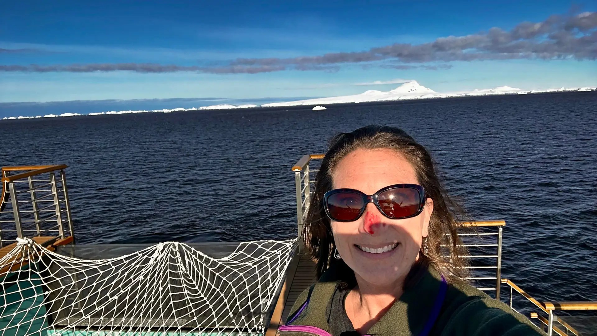 I earned my red nose by kissing the fish