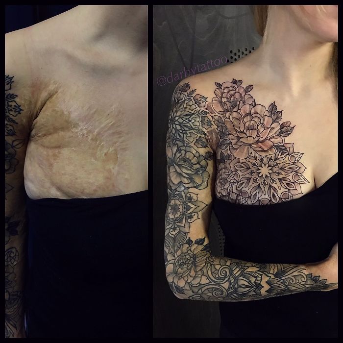 18 Times When Tattoo Artist Made Scars And Birthmarks Looks Beautiful 700_x_700_jpg