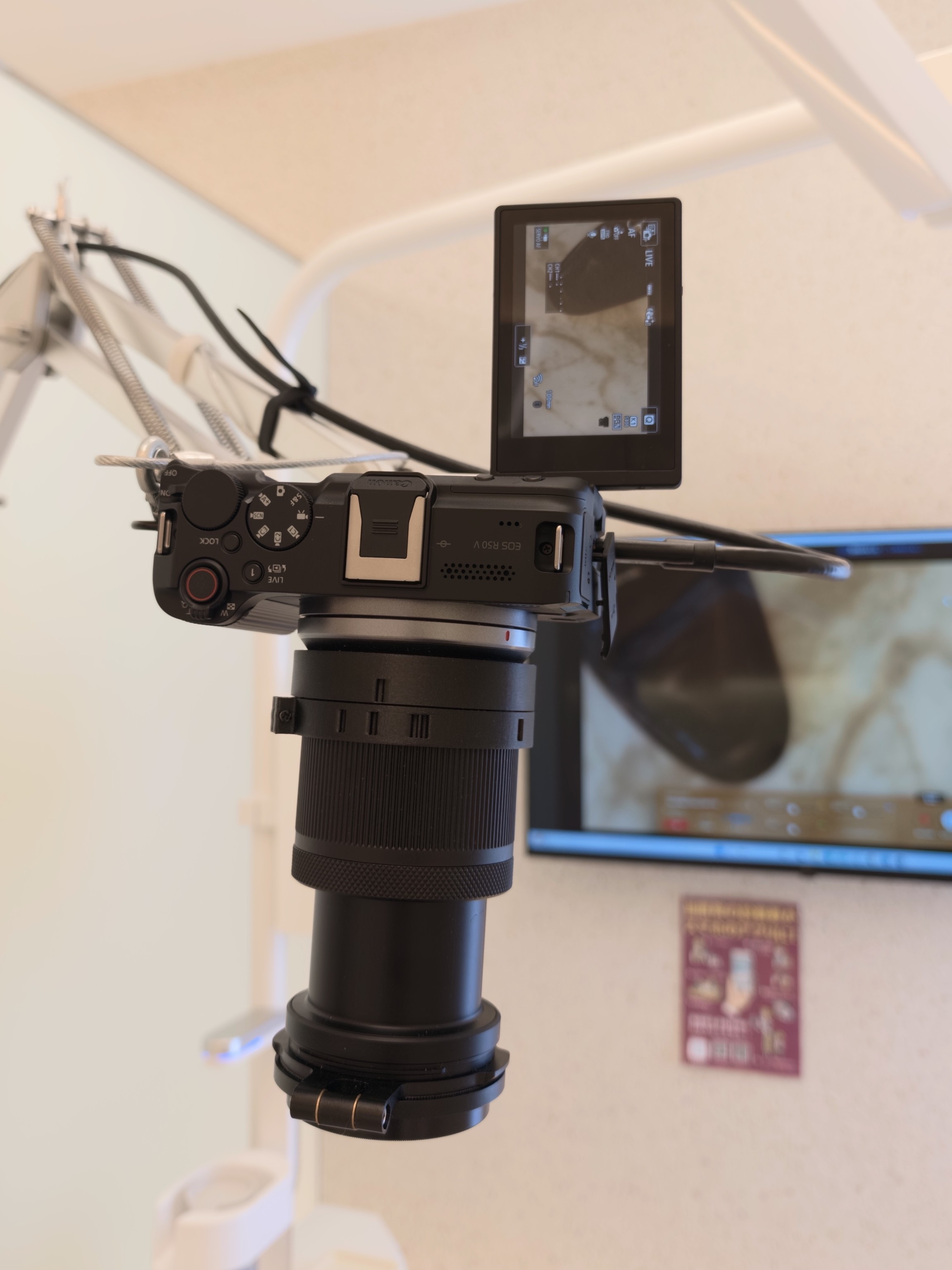 口腔内写真カメラセット【高画素】D7100 口腔内写真カメラセット | ORAL PHOTOGRAPHY