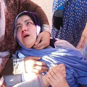SAHARA OCCIDENTAL | La agresión a dos activistas saharauis deja al descubierto la brutalidad de las fuerzas de ocupación marroquí – Resumen Latinoamericano