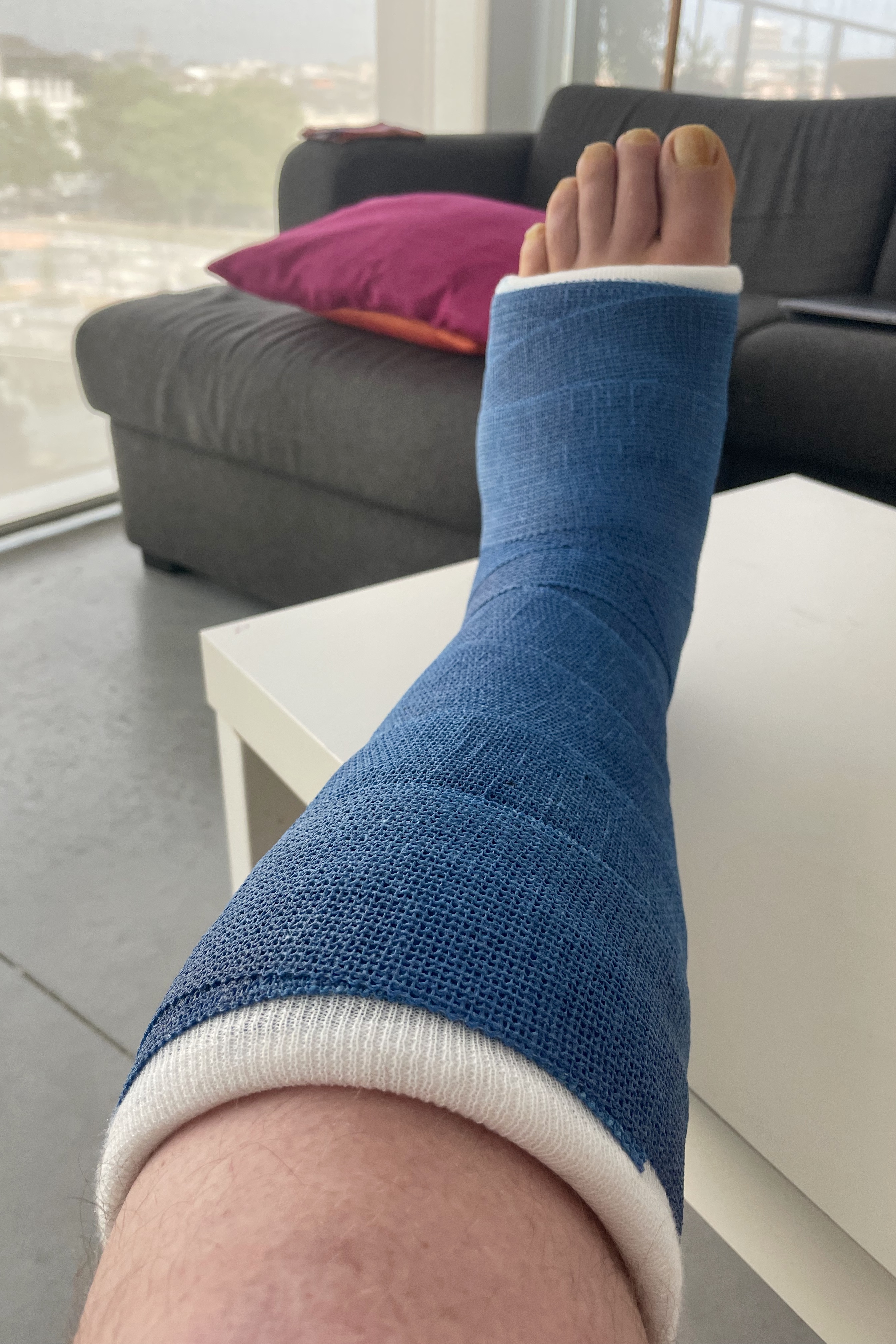Broken foot, Brussels, Belgium