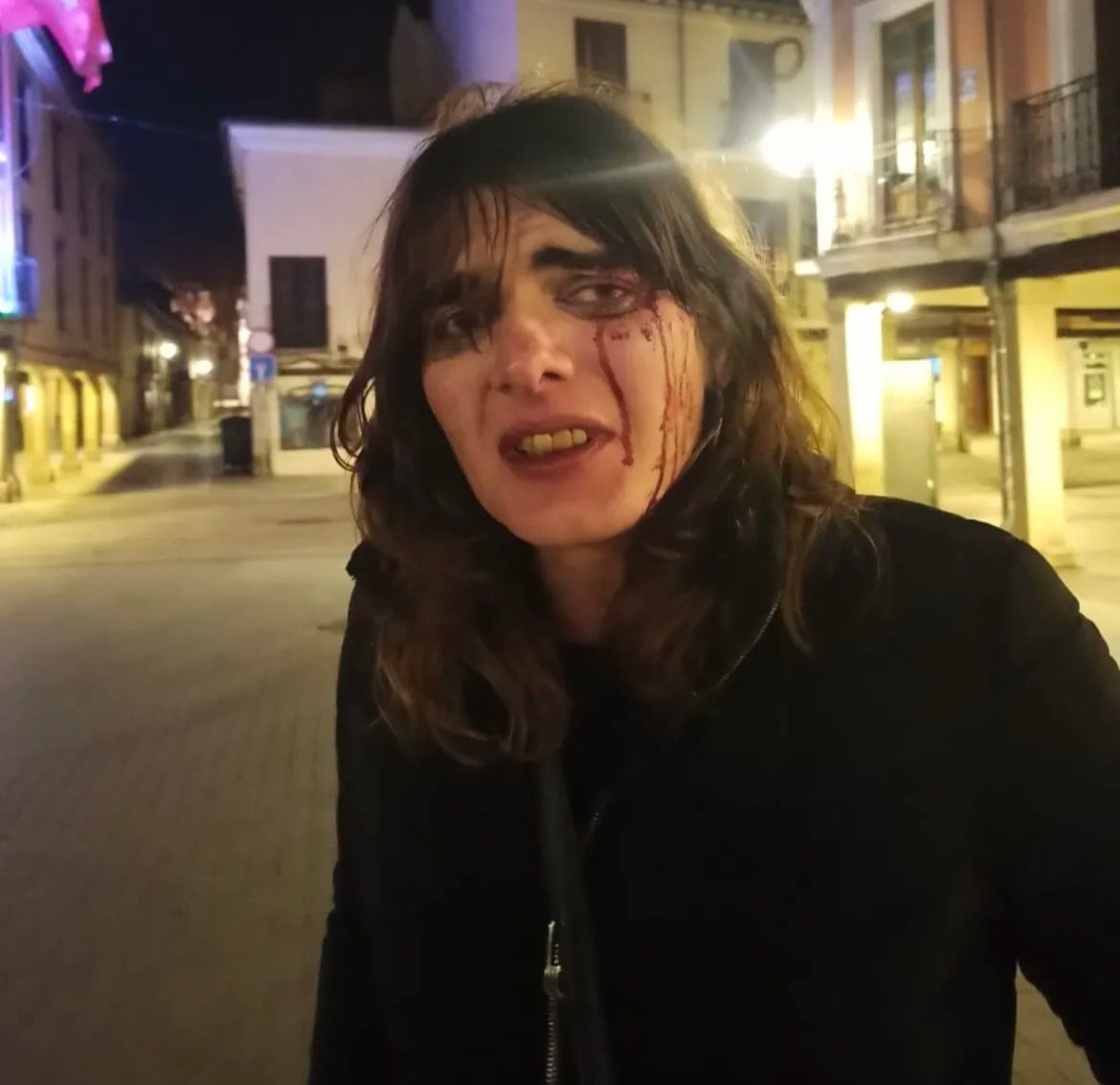 mujer agredida en Alcalá