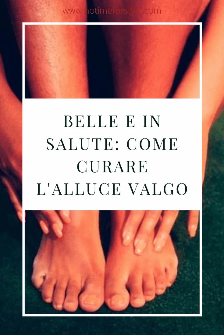 prevenire e curare l'alluce valgo