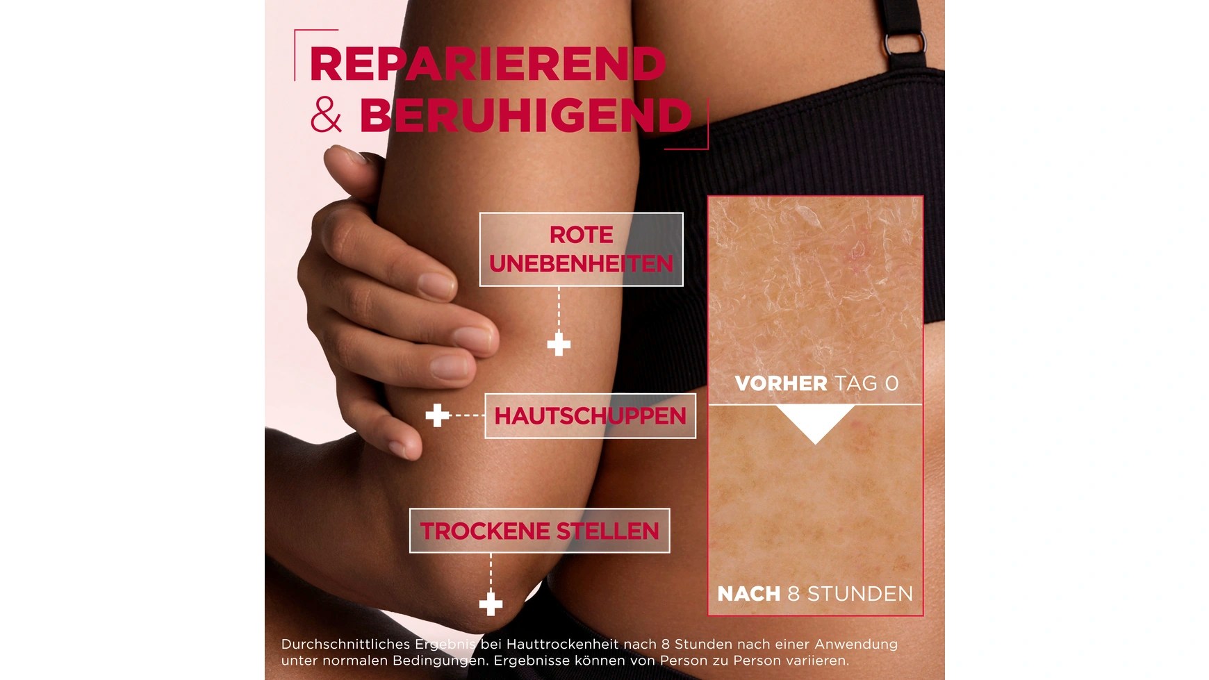 Urea_Cica_Repair_hauterneuernde_Creme_from_Mixa_1-1.webp