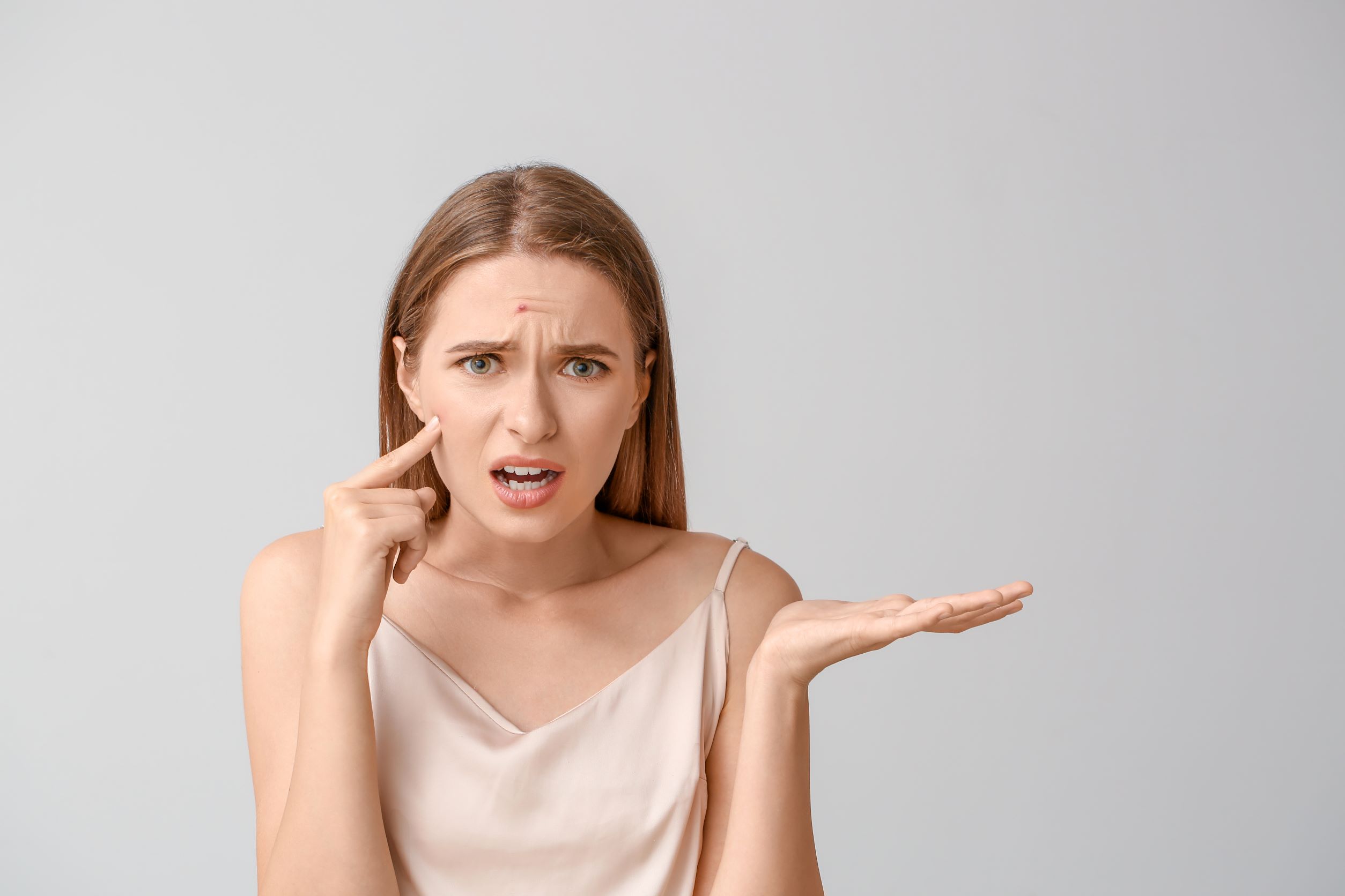 Should you pop pimples