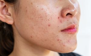does panthenol clog pores