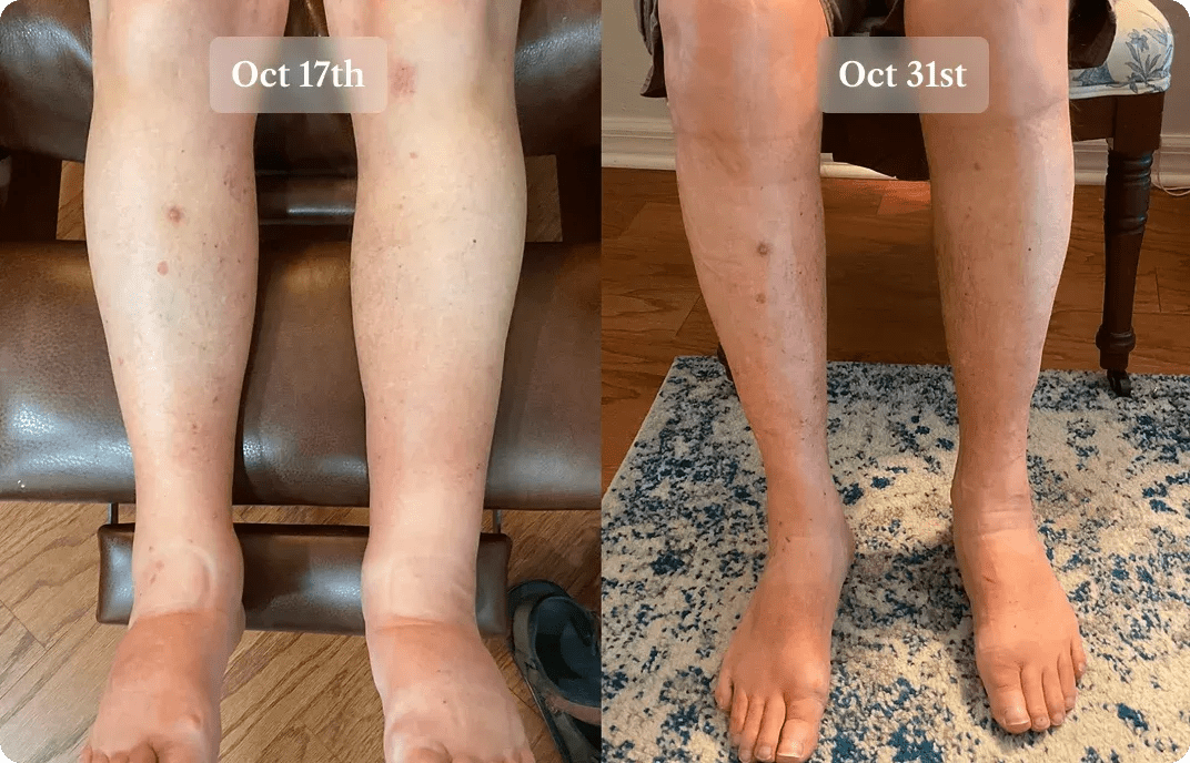 Property 1=Variant4 (1)