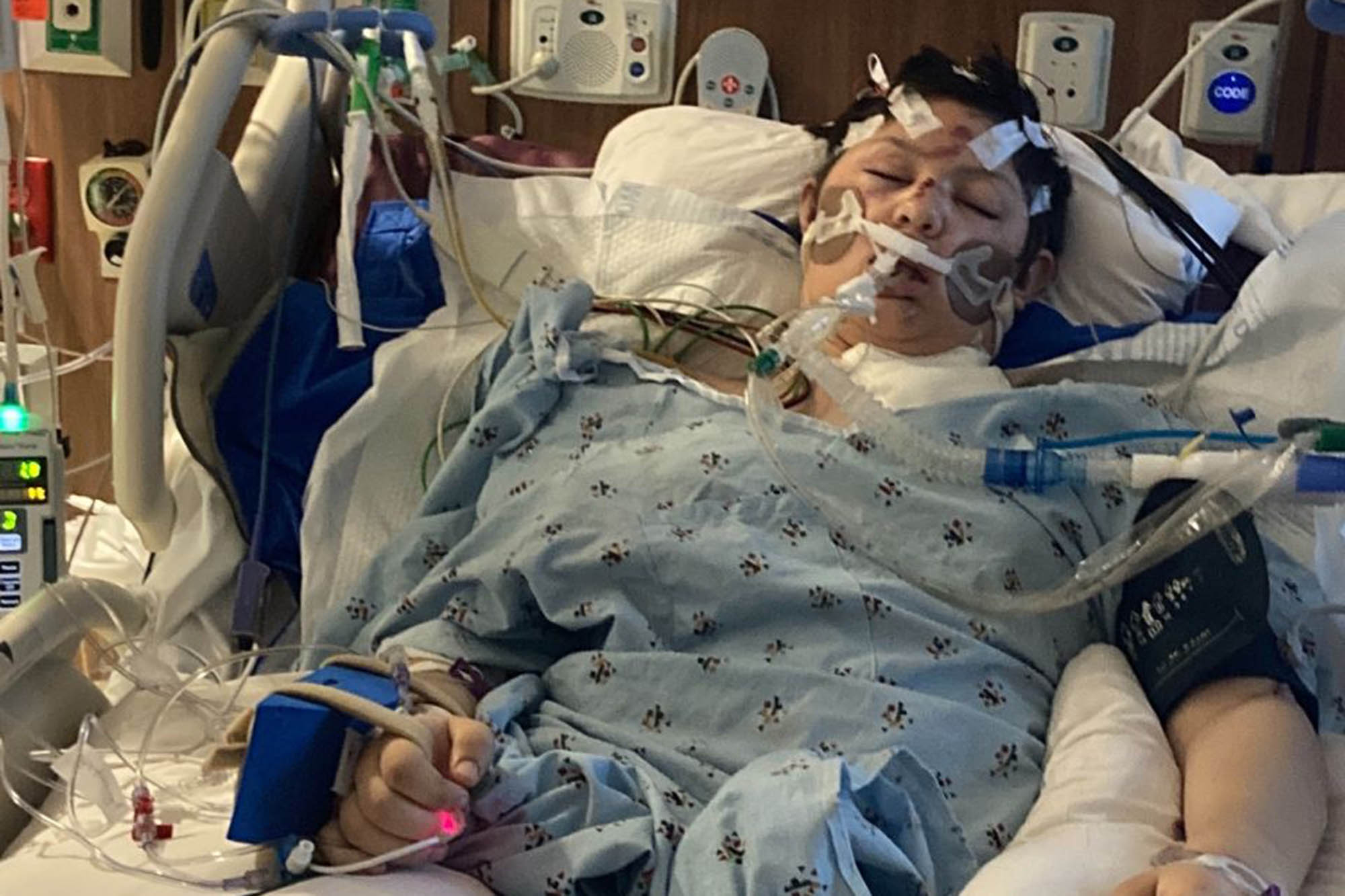 Kollie told police he was high on . North Dakota teen girl dies after attack while skateboarding
