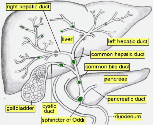 Ppt Biliary Tract Disease Powerpoint Presentation Free Download Id 3334620