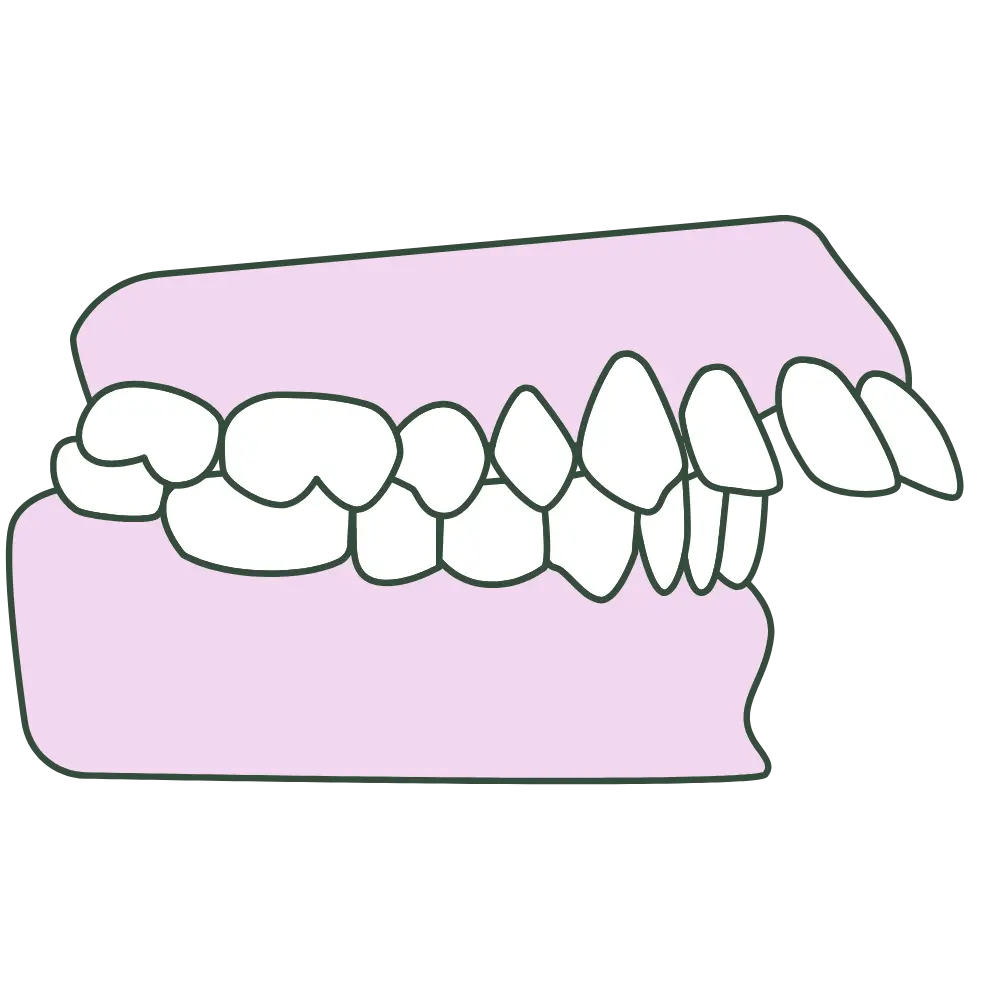 front tooth protrusion profile