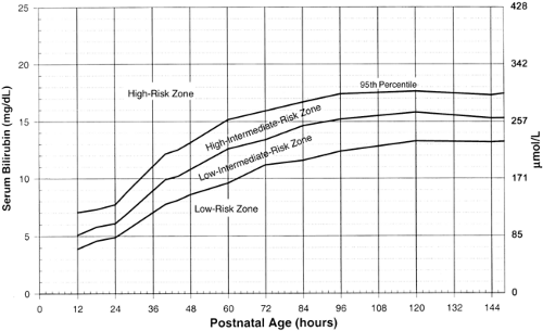Newer Developments that Affect Our Approach to the Jaundiced Newborn ...