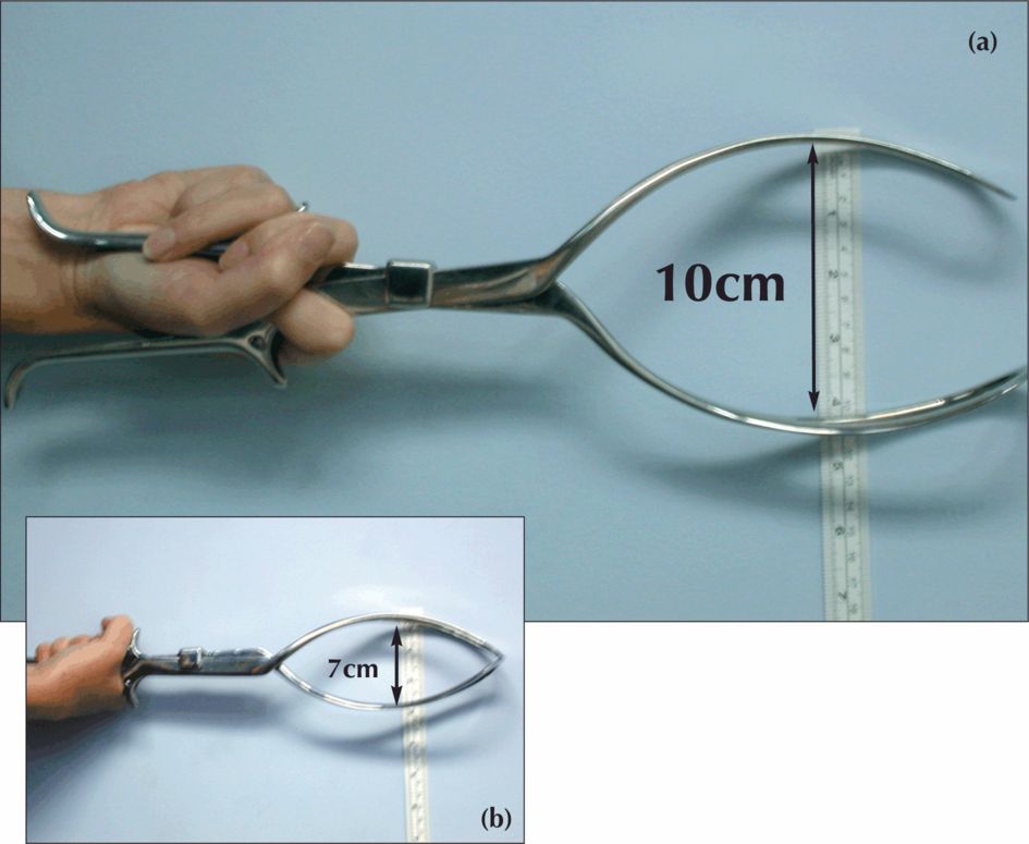 Ventouse and forceps delivery Obgyn Key