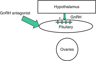 GnRH Antagonist in Ovarian Stimulation | Obgyn Key