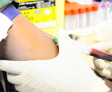 Experts call for change in Uganda’s HIV strategy