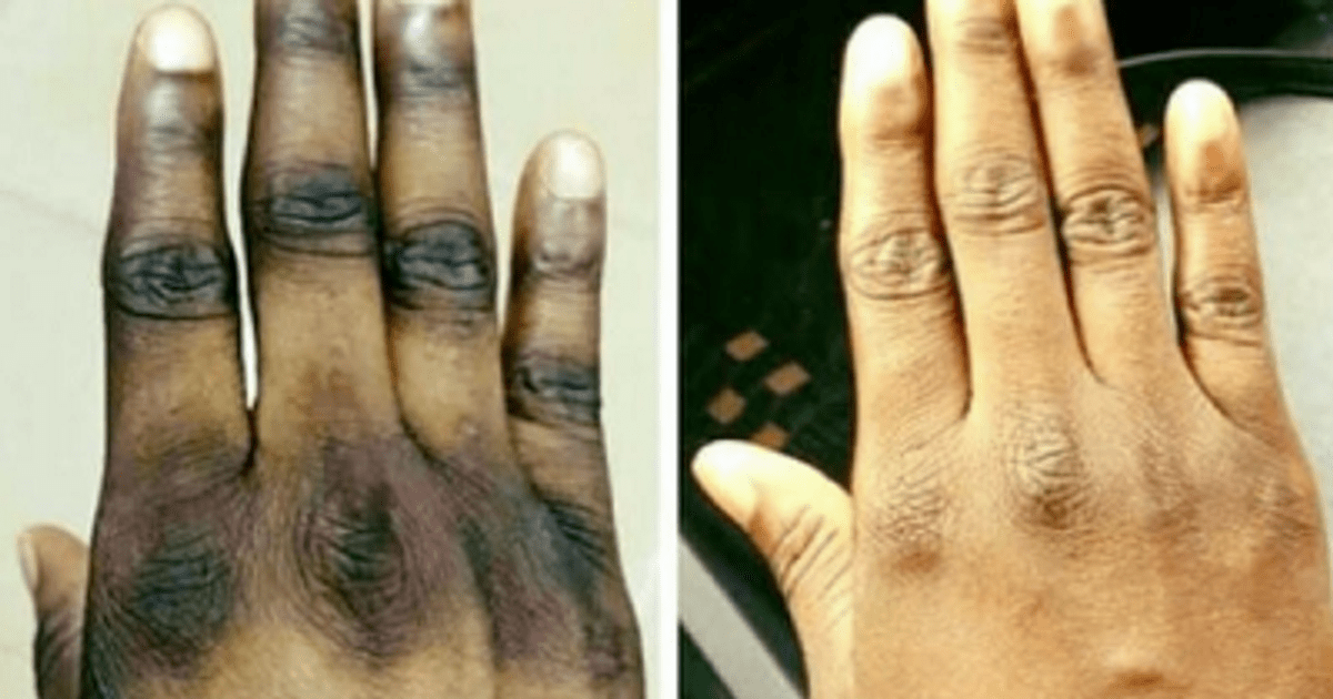 ✓fri frakt över 199 kr ✓snabba leveranser ✓garanterat äkta . Here are 41 harmful cosmetic products on the Ghanaian