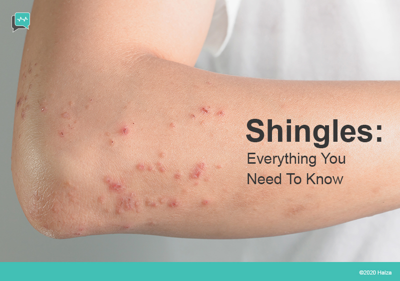 Children Get Shingles
