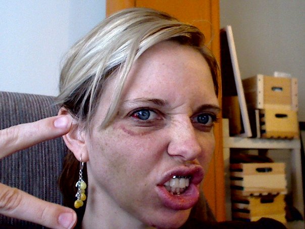 brokenface