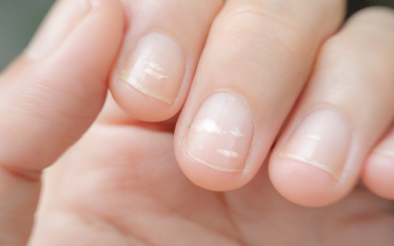 健康状態を知りたいなら、爪のここをいますぐ見て！