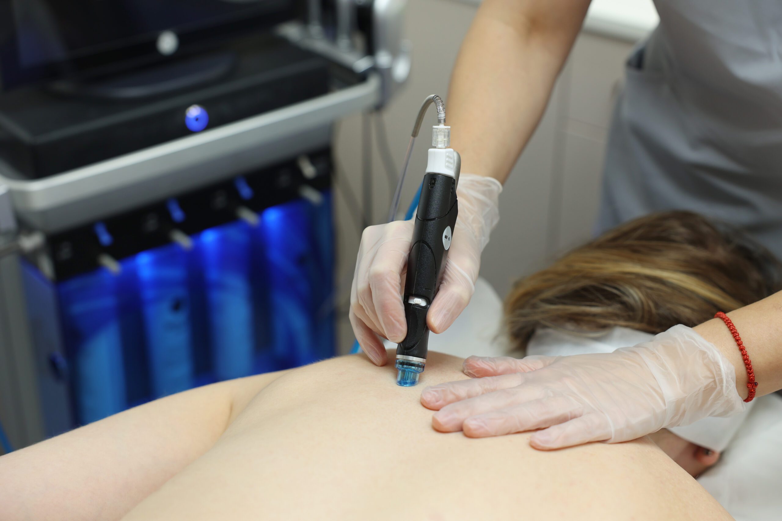 HydraBack Treatment part of hydrafacial family
