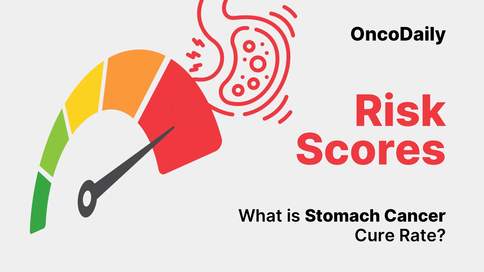 Stomach Cancer Cure Rates: 2025 Update | OncoDaily (2025)