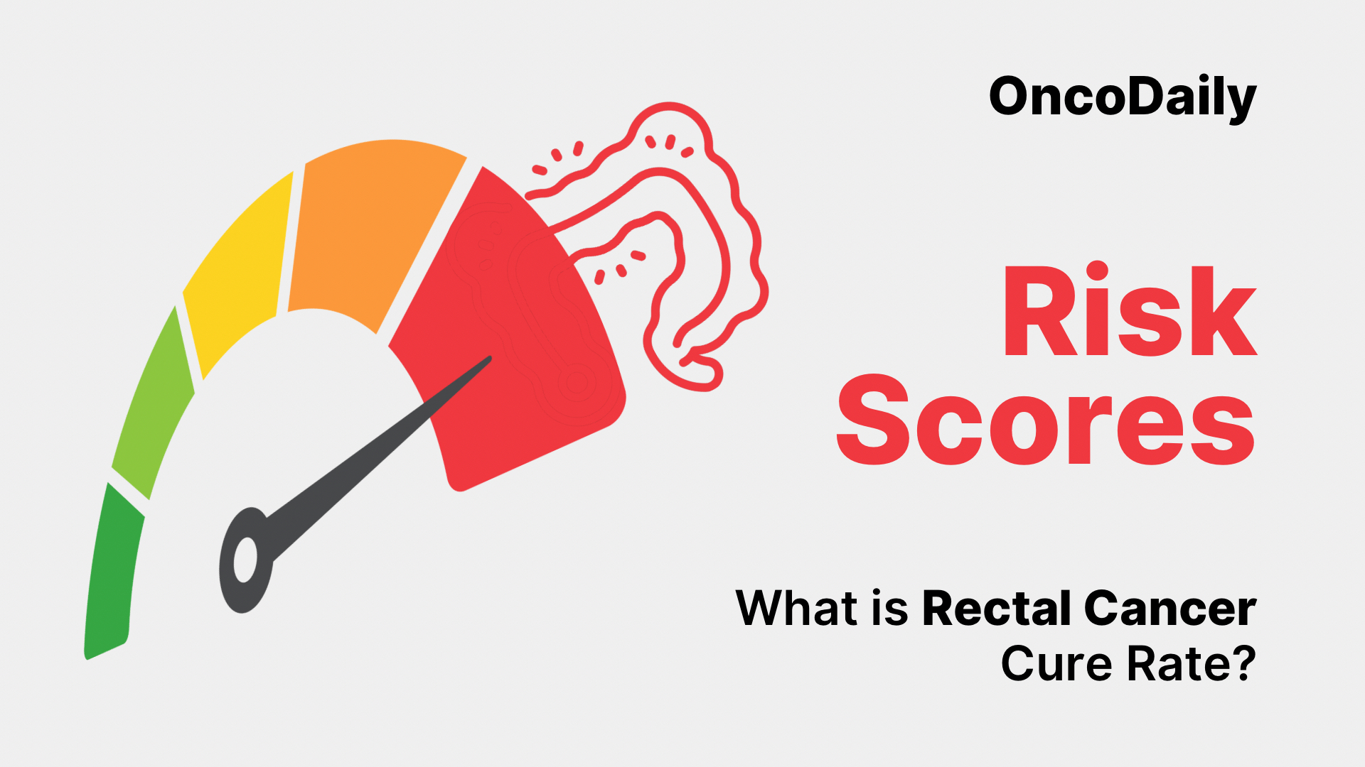 Rectal Cancer: Understanding Cure Rates and Treatment Advances (2025)