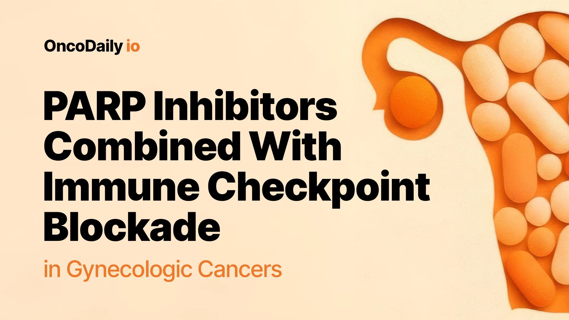 PARP Inhibitors and Immune Therapy: A New Approach for Gynecologic Cancers (2026)