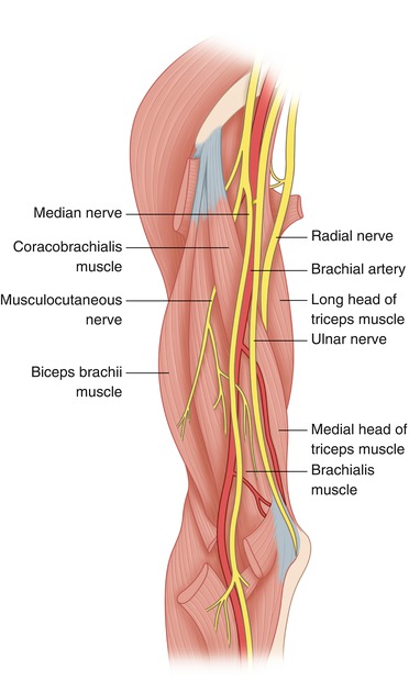 These 20 triceps exercises, many of which emphasize the isolation of the biggest muscle in the arm, are designed to stimulate muscle growth to build strength. Tumor In The Anterior Compartment Of The Arm Oncohema Key