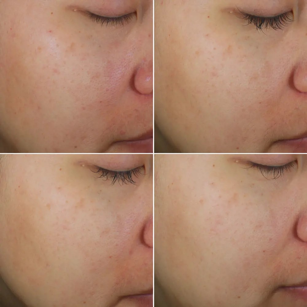 Bright Intense Routine Mixed