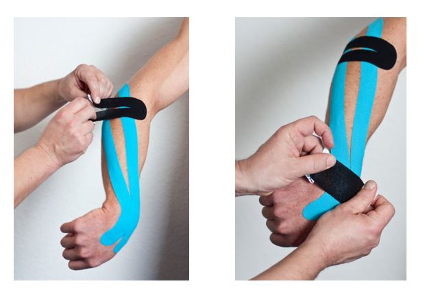 Komplette kinesiotape anleitung zum tapen eines tennisarm und ellenbogen. Tennisarm Tapen . Kinesiologisches Tapen Bei Einem Tennisarm Orthinform
