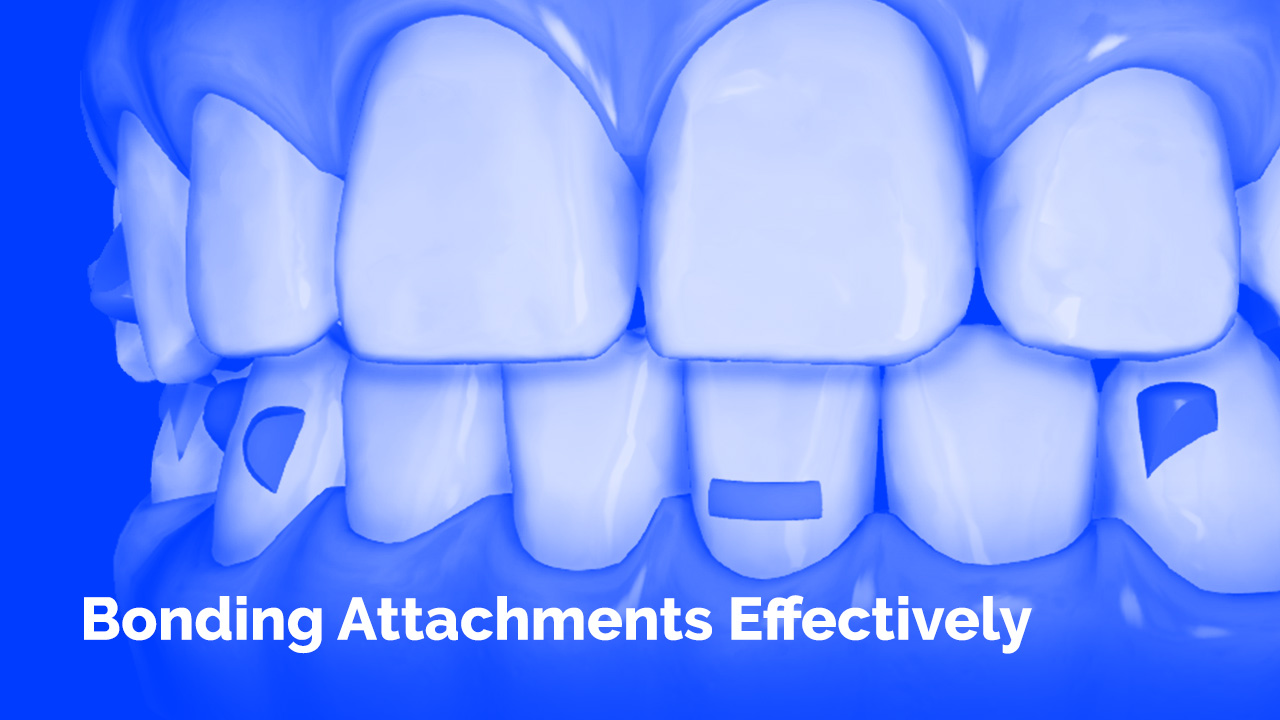 [Premium] Bonding Attachments Effectively
