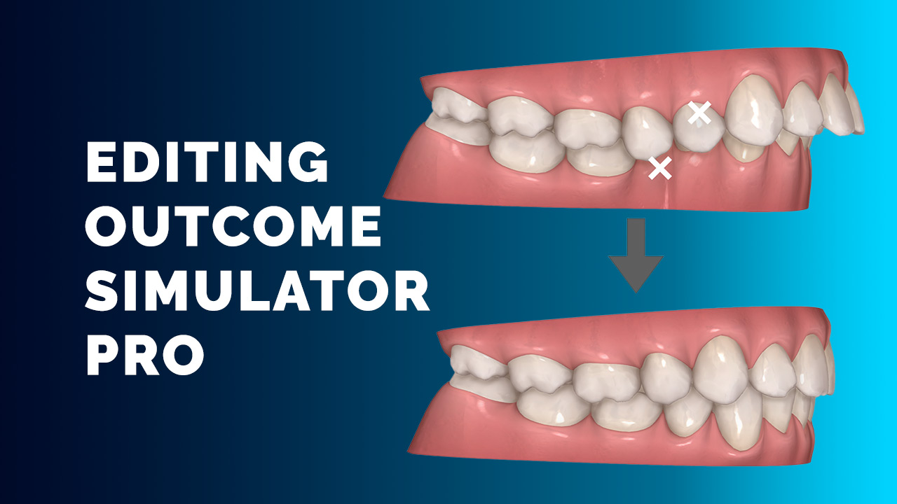 Editing Outcome Simulator Pro
