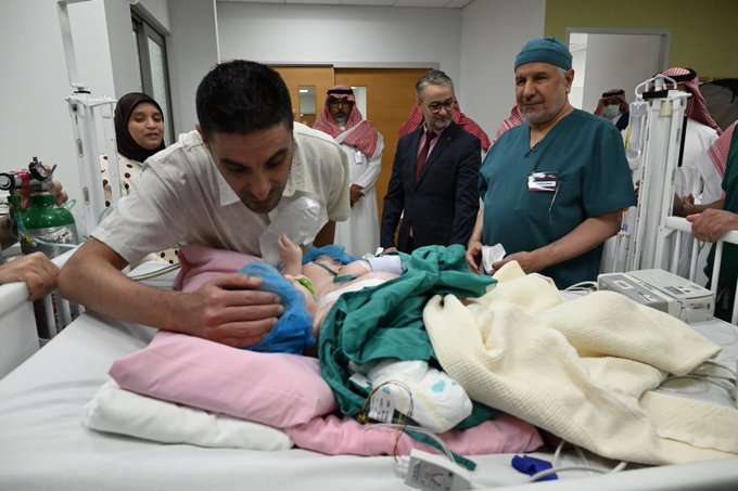 فريق طبي جراحي ينجح في عملية فصل التوأم الملتصق المغربي “سجى وضحى”