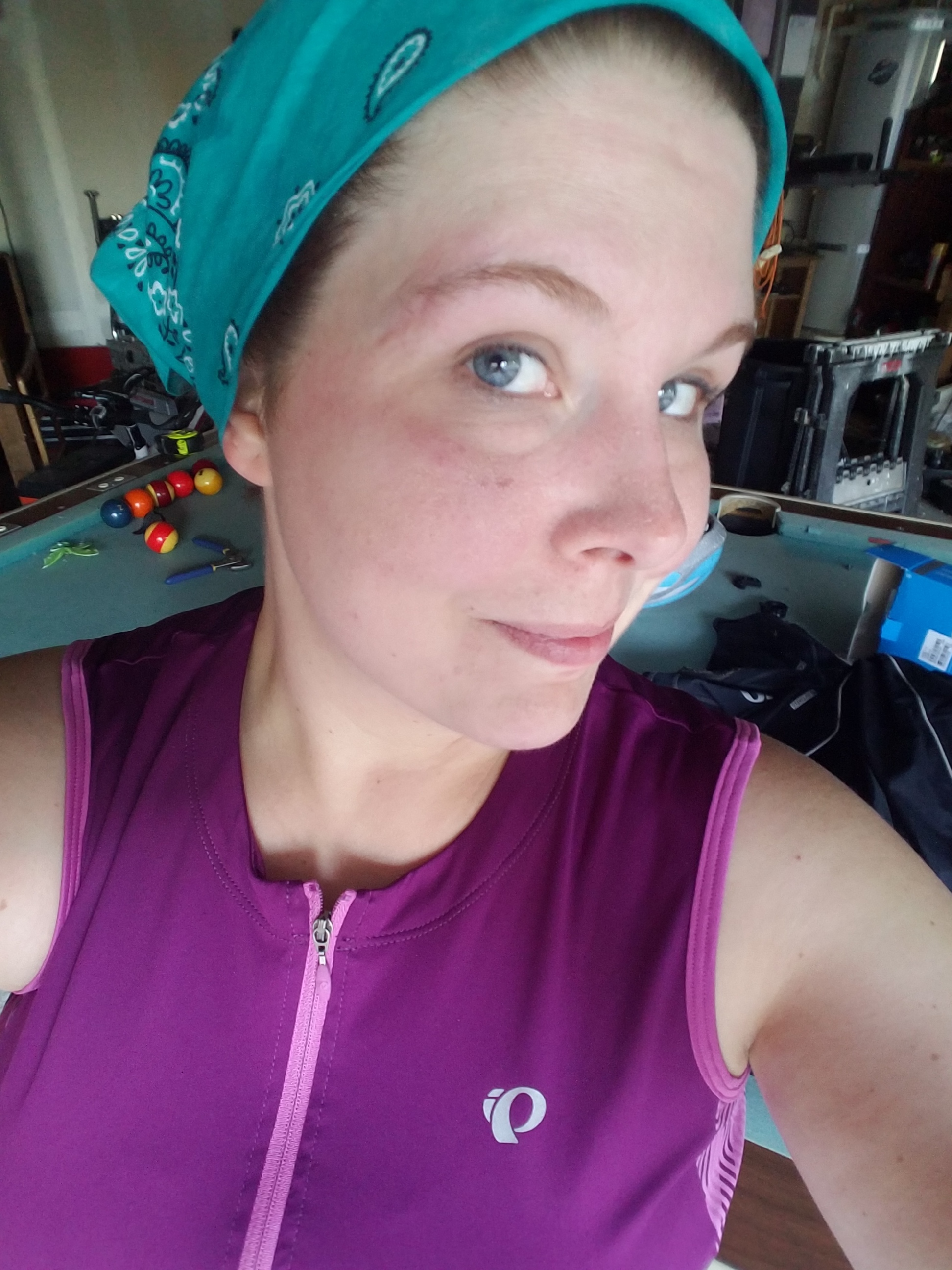 Face scars today, just returned from my longest ride getting back on the bike, 12.5 miles