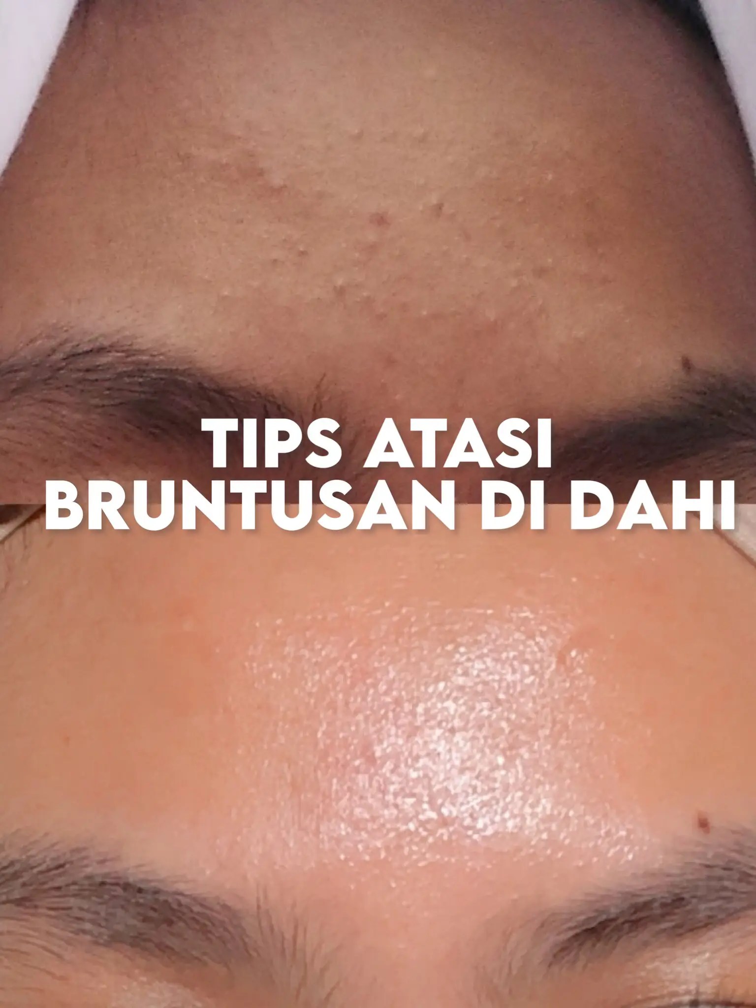TIPS