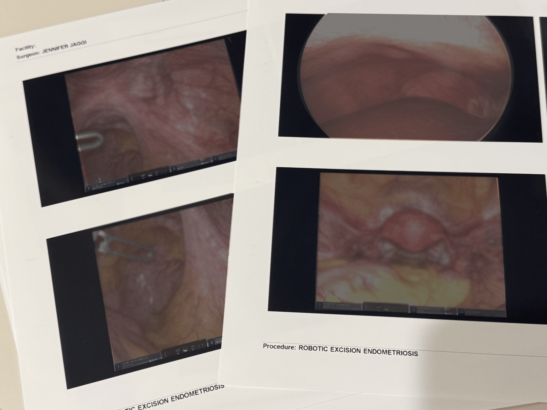 “A Picture Is Worth a Thousand Words”: Why We Ask for Photos from Prior Surgeries
