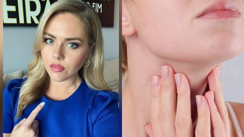 berita viral terbaru: presenter mengidap kanker