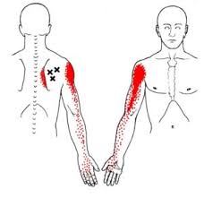 Trigger point therapy San Francisco