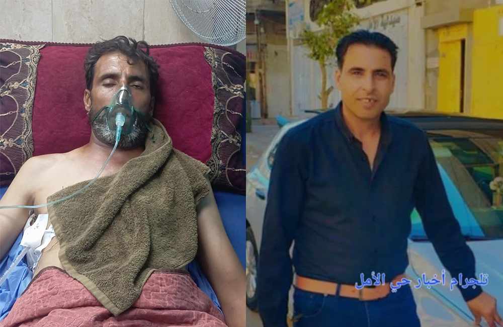 أنور بسيسة .. رصاص الاحتلال يحيله مقعدًا أثناء بحثه عن طعام أطفاله
