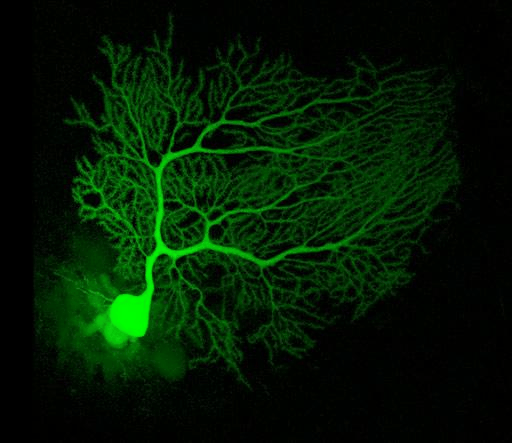 Purkinje neurons in the cerebellum viewed by optical microscopy