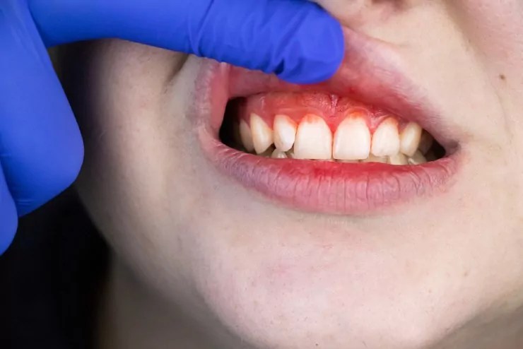 Pediatric Dentist in Junagadh Children Dental Clinic In Junagadh Kids Dentist In Junagadh