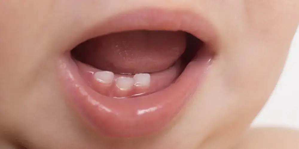 Pediatric Dentist in Junagadh Children Dental Clinic In Junagadh Kids Dentist In Junagadh