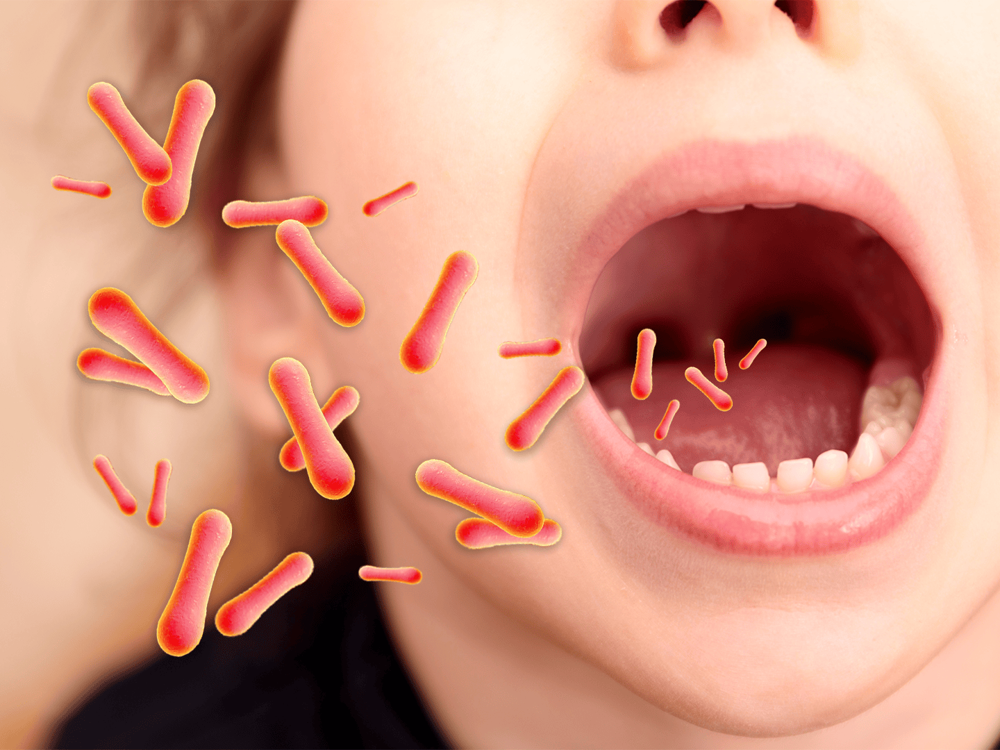 Diphtheria Resurgence: Why This Forgotten Disease is Back in Australia (2026)