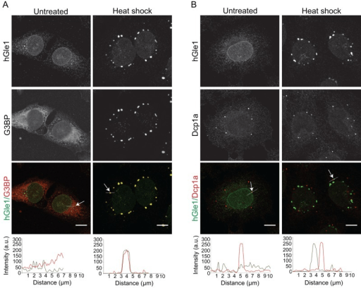 How Do Cells Respond To Stress Pathosomes